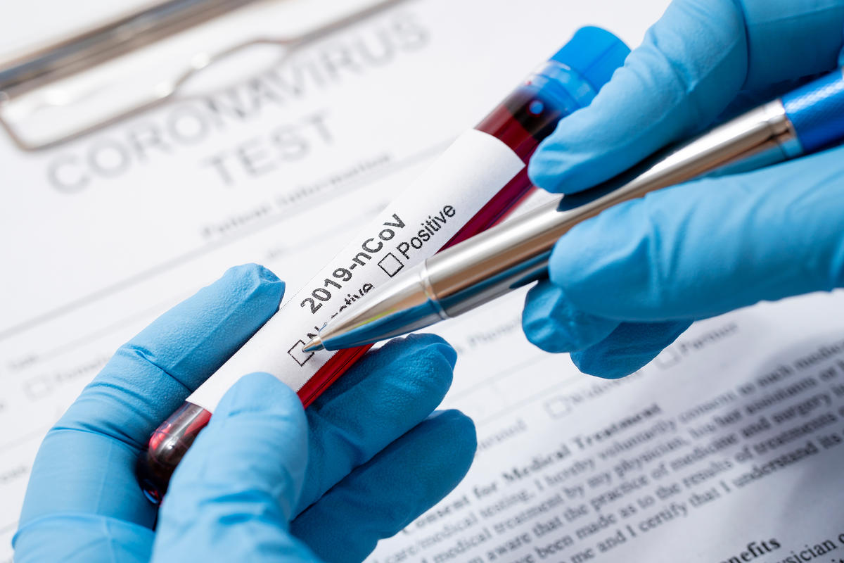 Coronavirus-Test - Symbolbild